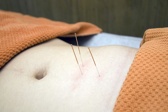 léčba akupunkturou